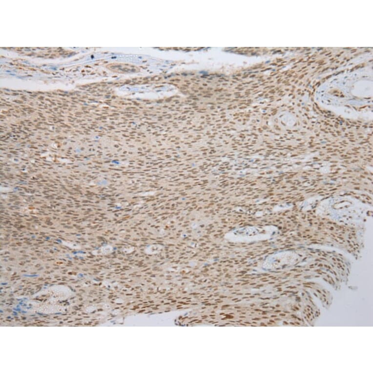 Immunohistochemistry - ANKRD1 Antibody from Signalway Antibody (42714) - Antibodies.com
