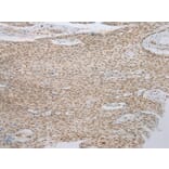 Immunohistochemistry - ANKRD1 Antibody from Signalway Antibody (42714) - Antibodies.com