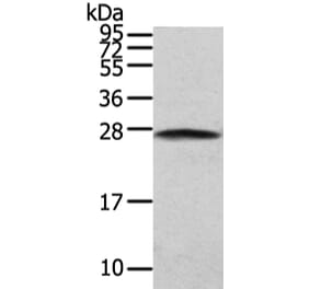 PGRMC2 Antibody from Signalway Antibody (42721) - Antibodies.com