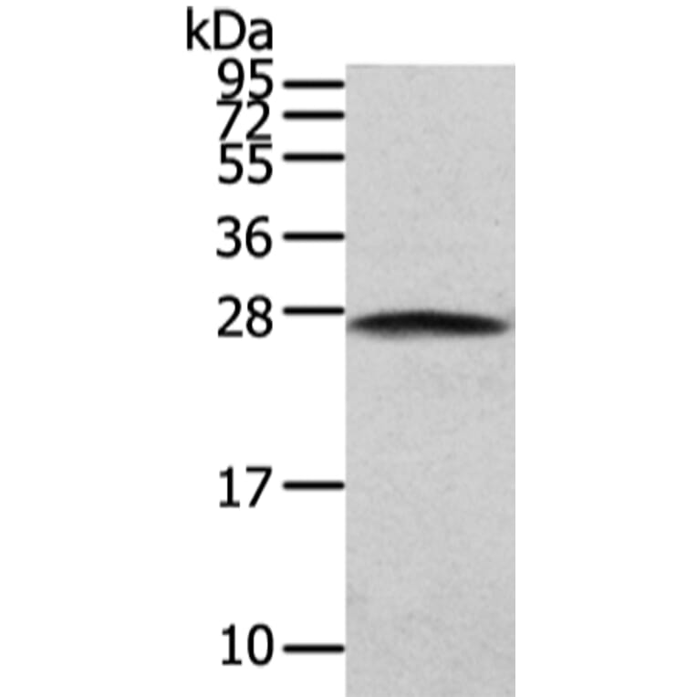 PGRMC2 Antibody from Signalway Antibody (42721) - Antibodies.com