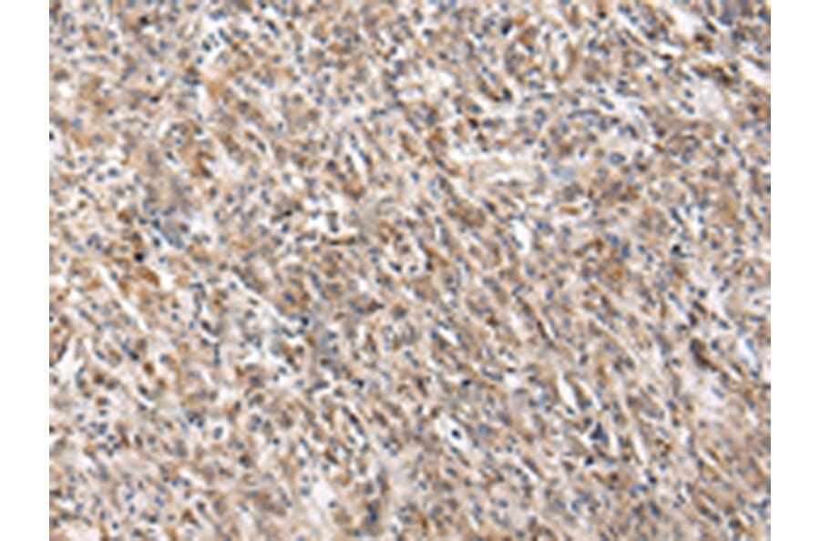 Immunohistochemistry - PGRMC2 Antibody from Signalway Antibody (42721) - Antibodies.com