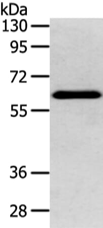 Gel: 8% SDS-PAGE Lysate: 80 &#956;g Lane: Mouse brain tissue Primary antibody: 1/400 dilution Secondary antibody: Goat anti rabbit IgG at 1/8000 dilution Exposure time: 5 seconds