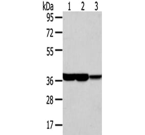 TALDO1 Antibody from Signalway Antibody (42784) - Antibodies.com