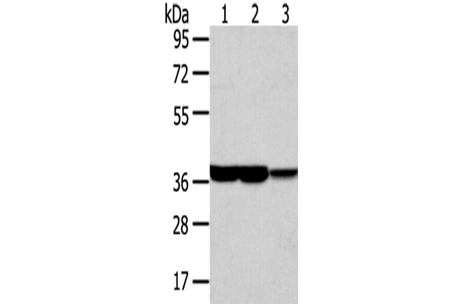 TALDO1 Antibody from Signalway Antibody (42784) - Antibodies.com