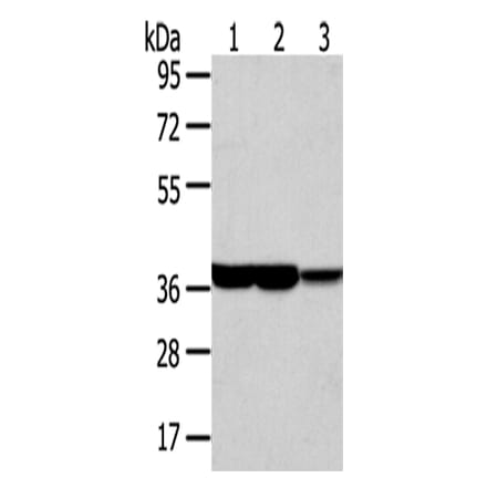 TALDO1 Antibody from Signalway Antibody (42784) - Antibodies.com