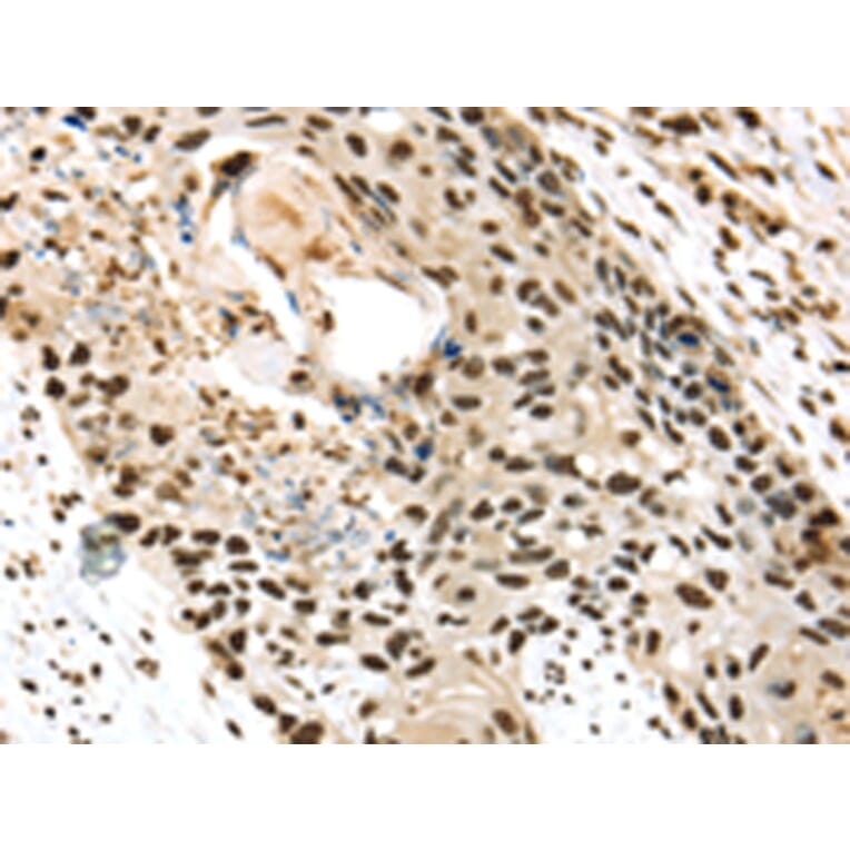 Immunohistochemistry - TALDO1 Antibody from Signalway Antibody (42784) - Antibodies.com