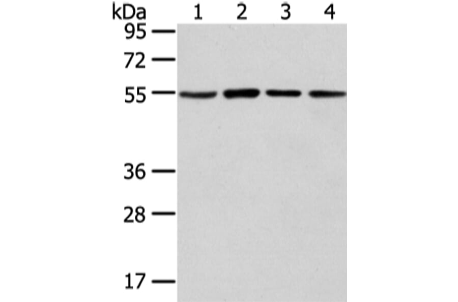 TUBA1C Antibody from Signalway Antibody (42796) - Antibodies.com