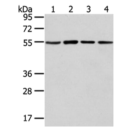 TUBA1C Antibody from Signalway Antibody (42796) - Antibodies.com