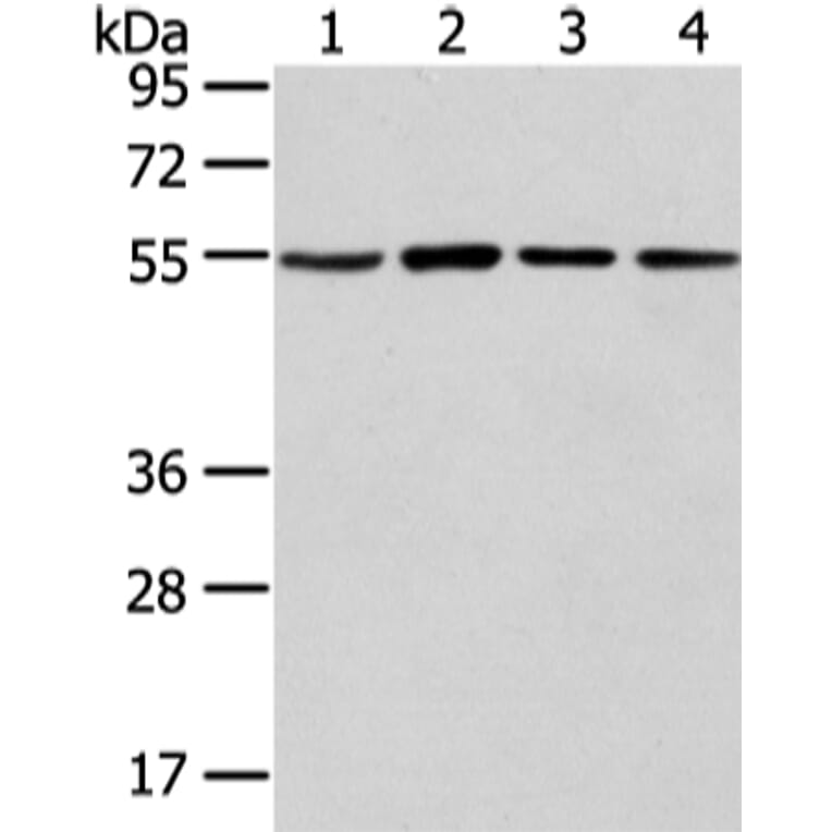 TUBA1C Antibody from Signalway Antibody (42796) - Antibodies.com