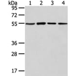 TUBA1C Antibody from Signalway Antibody (42796) - Antibodies.com