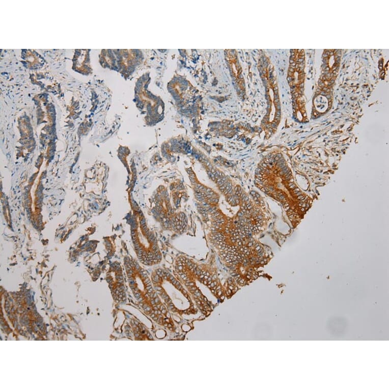 Immunohistochemistry - TUBA1C Antibody from Signalway Antibody (42796) - Antibodies.com