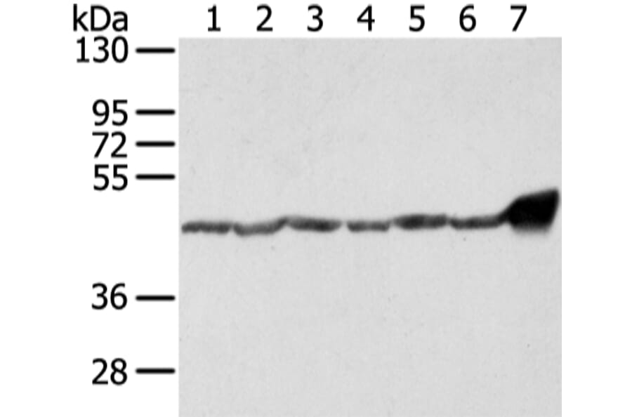 UQCRC1 Antibody from Signalway Antibody (42814) - Antibodies.com
