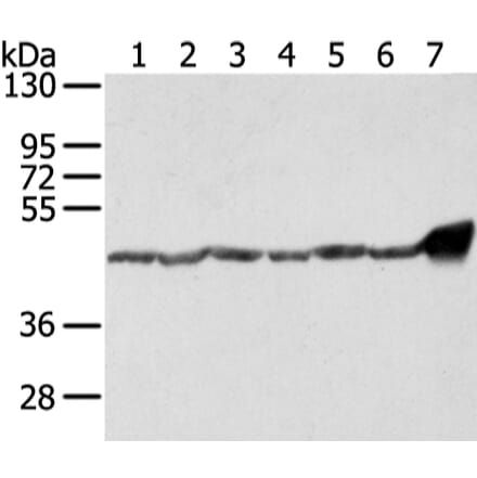 UQCRC1 Antibody from Signalway Antibody (42814) - Antibodies.com