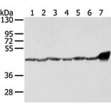 UQCRC1 Antibody from Signalway Antibody (42814) - Antibodies.com