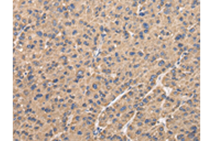 Immunohistochemistry - UQCRC1 Antibody from Signalway Antibody (42814) - Antibodies.com