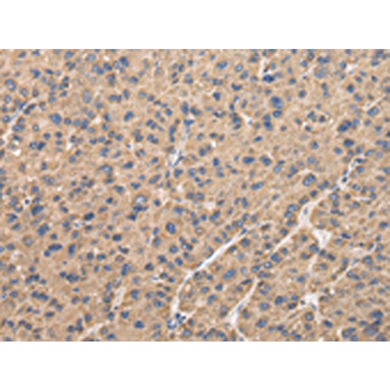 Immunohistochemistry - UQCRC1 Antibody from Signalway Antibody (42814) - Antibodies.com