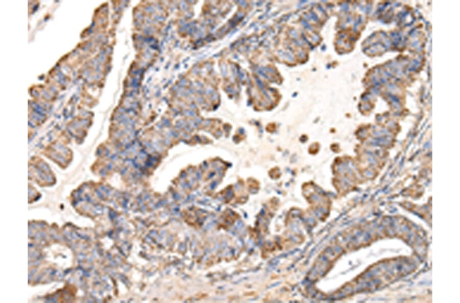 Immunohistochemistry - UQCRC1 Antibody from Signalway Antibody (42814) - Antibodies.com