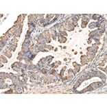 Immunohistochemistry - UQCRC1 Antibody from Signalway Antibody (42814) - Antibodies.com