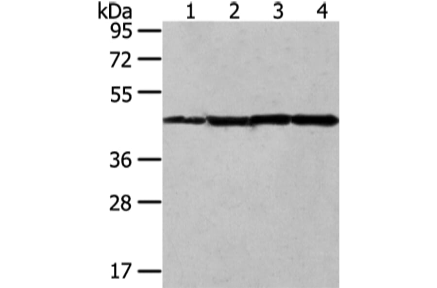 UQCRC2 Antibody from Signalway Antibody (42815) - Antibodies.com