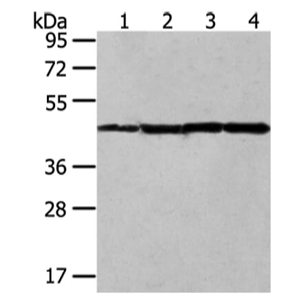 UQCRC2 Antibody from Signalway Antibody (42815) - Antibodies.com