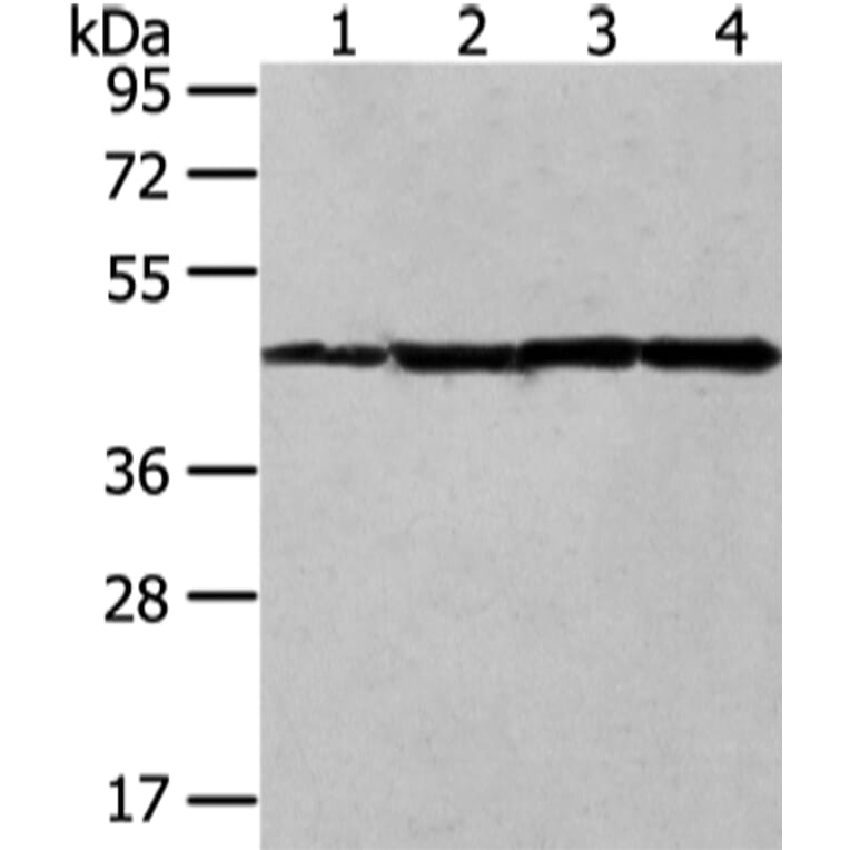 UQCRC2 Antibody from Signalway Antibody (42815) - Antibodies.com