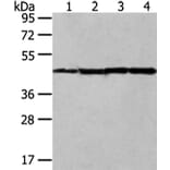 UQCRC2 Antibody from Signalway Antibody (42815) - Antibodies.com