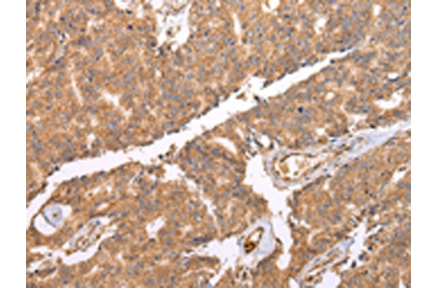 Immunohistochemistry - UQCRC2 Antibody from Signalway Antibody (42815) - Antibodies.com