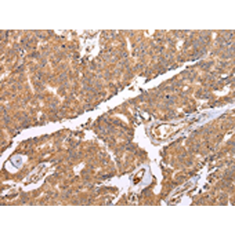 Immunohistochemistry - UQCRC2 Antibody from Signalway Antibody (42815) - Antibodies.com