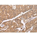 Immunohistochemistry - UQCRC2 Antibody from Signalway Antibody (42815) - Antibodies.com