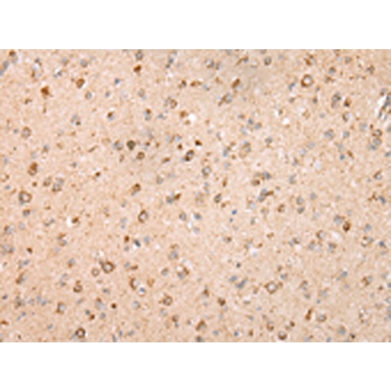 Immunohistochemistry - UQCRC2 Antibody from Signalway Antibody (42815) - Antibodies.com