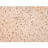 Immunohistochemistry - UQCRC2 Antibody from Signalway Antibody (42815) - Antibodies.com