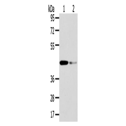 VPS37A Antibody from Signalway Antibody (42844) - Antibodies.com