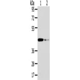 VPS37A Antibody from Signalway Antibody (42844) - Antibodies.com