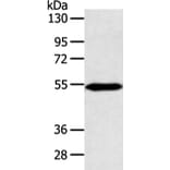 ZNF239 Antibody from Signalway Antibody (42876) - Antibodies.com