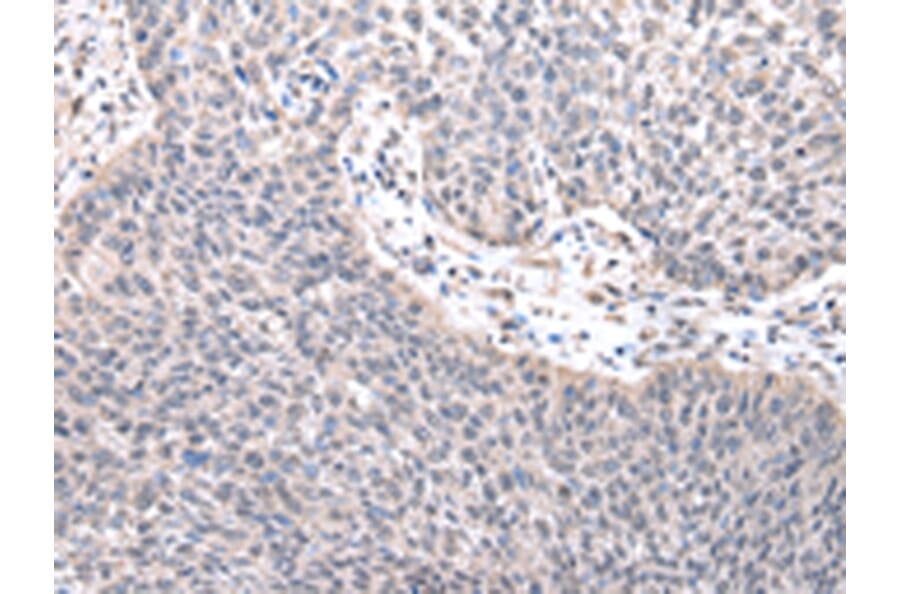 Immunohistochemistry - ZNF239 Antibody from Signalway Antibody (42876) - Antibodies.com