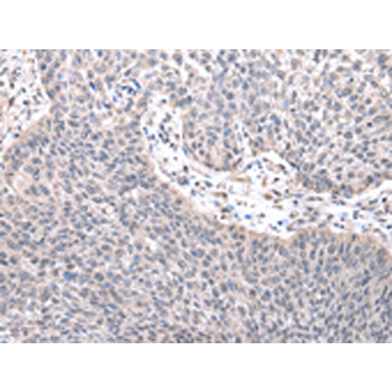 Immunohistochemistry - ZNF239 Antibody from Signalway Antibody (42876) - Antibodies.com