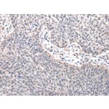 Immunohistochemistry - ZNF239 Antibody from Signalway Antibody (42876) - Antibodies.com