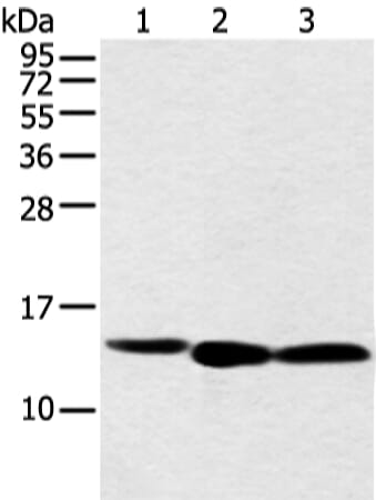 Gel: 12% SDS-PAGE Lysate: 40 &#956;g Lane 1-3: Hela, PC3 and 293T cell Primary antibody: 1/500 dilution Secondary antibody: Goat anti rabbit IgG at 1/8000 dilution Exposure time: 30 seconds
