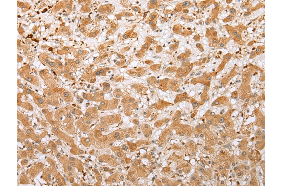 Immunohistochemistry - NDUFB3 Antibody from Signalway Antibody (42882) - Antibodies.com