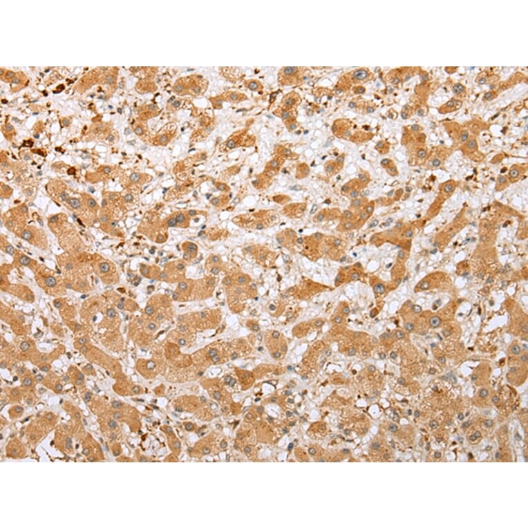 Immunohistochemistry - NDUFB3 Antibody from Signalway Antibody (42882) - Antibodies.com