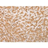 Immunohistochemistry - NDUFB3 Antibody from Signalway Antibody (42882) - Antibodies.com