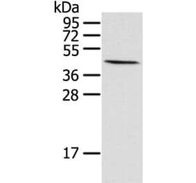 HIF1AN Antibody from Signalway Antibody (42894) - Antibodies.com
