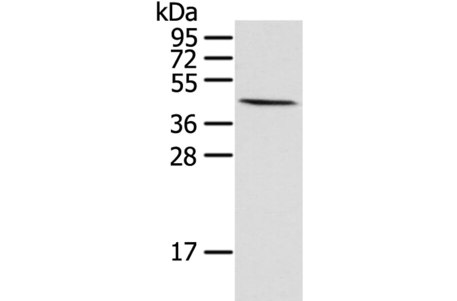 HIF1AN Antibody from Signalway Antibody (42894) - Antibodies.com