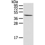HIF1AN Antibody from Signalway Antibody (42894) - Antibodies.com