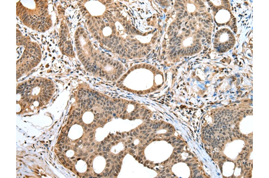 Immunohistochemistry - HIF1AN Antibody from Signalway Antibody (42894) - Antibodies.com