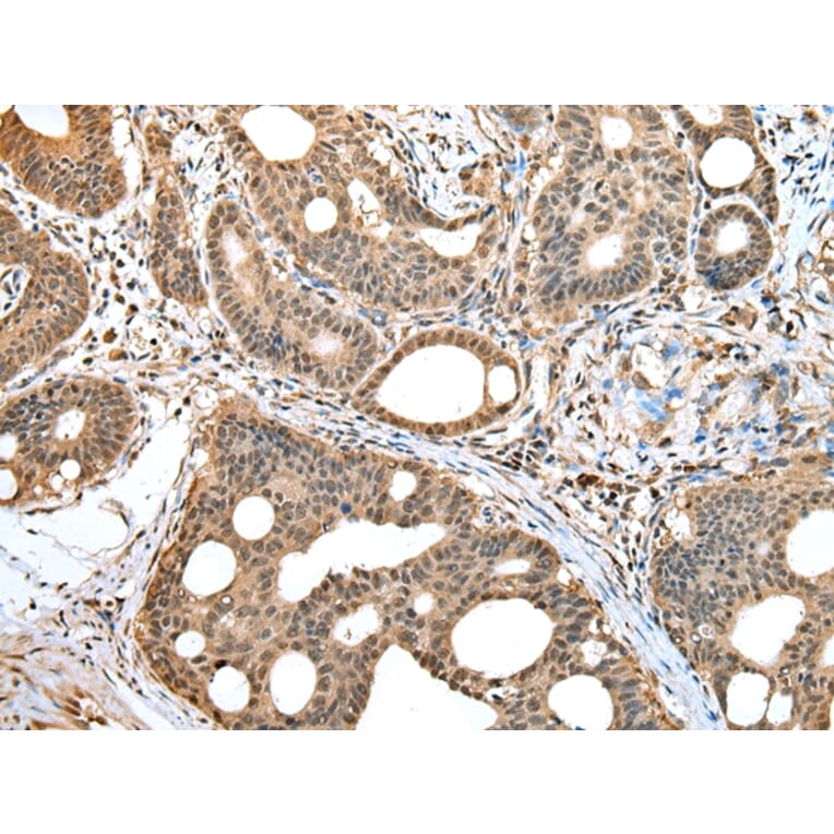 Immunohistochemistry - HIF1AN Antibody from Signalway Antibody (42894) - Antibodies.com
