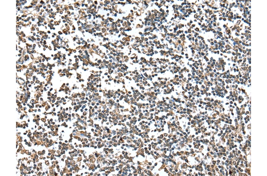 Immunohistochemistry - HIF1AN Antibody from Signalway Antibody (42894) - Antibodies.com