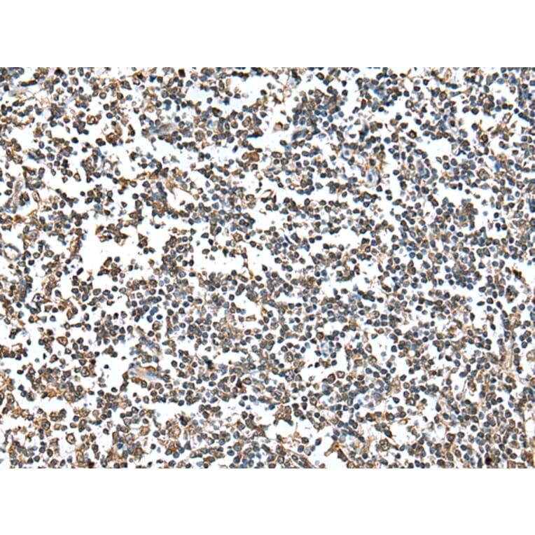 Immunohistochemistry - HIF1AN Antibody from Signalway Antibody (42894) - Antibodies.com