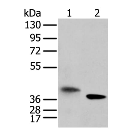 LRRC19 Antibody from Signalway Antibody (42917) - Antibodies.com