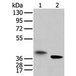 LRRC19 Antibody from Signalway Antibody (42917) - Antibodies.com